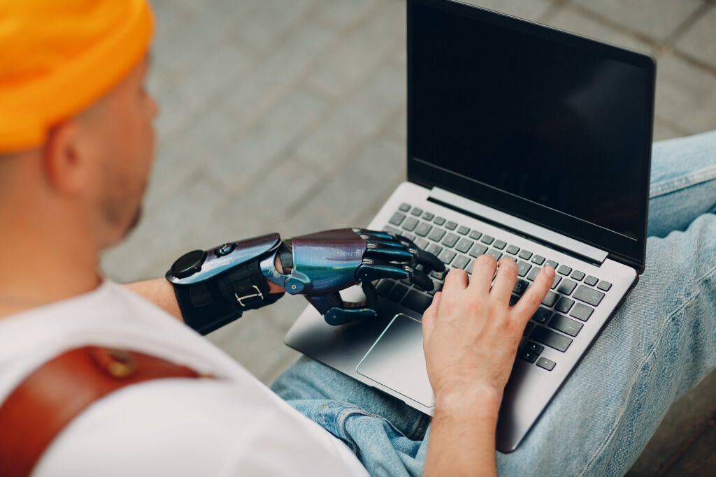 A young man in an orange beanie with a left-hand prosthetic works on a laptop outside